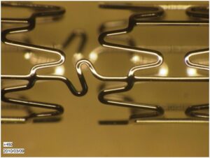 Chitra Cor Coronary Stent Launch