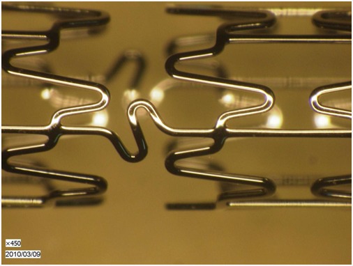 Chitra Cor Coronary Stent Launch